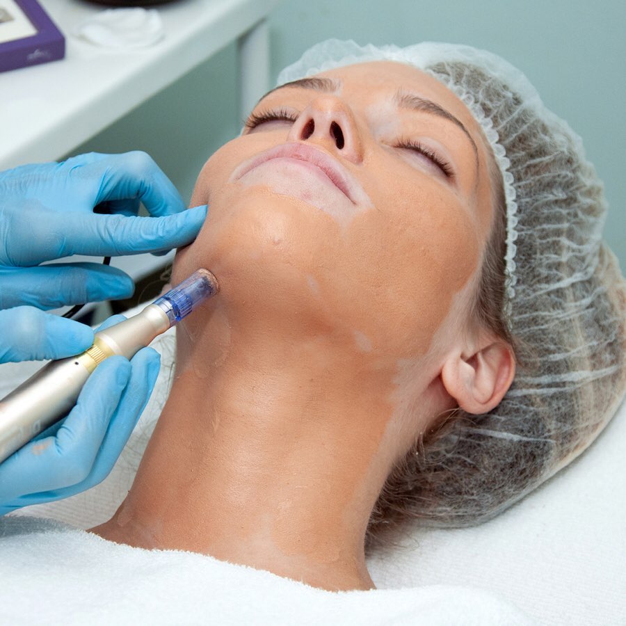 Dermapen facial profesional